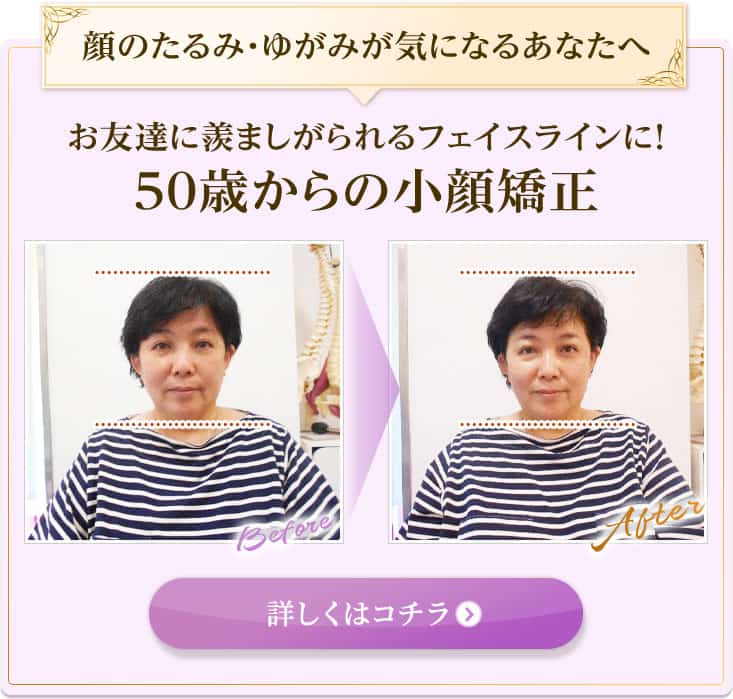 顔のたるみ・ゆがみが気になるあなたへ お友達に羨ましがられるフェイスラインに!50歳からの小顔矯正